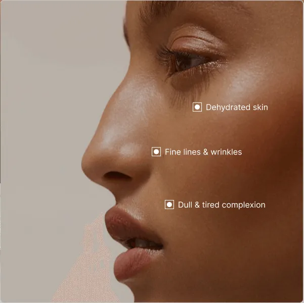 Mesotherapy delivers customized nutritional cocktails directly to your facial skin, significantly boosting hydration, firmness, and luminosity.