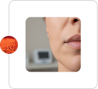 Fix Fine Lines and Wrinkles