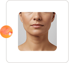 Structural Skin Support