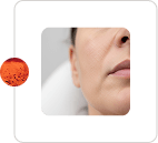 Skin Texture Refinement