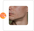 Skin-Specific Precision