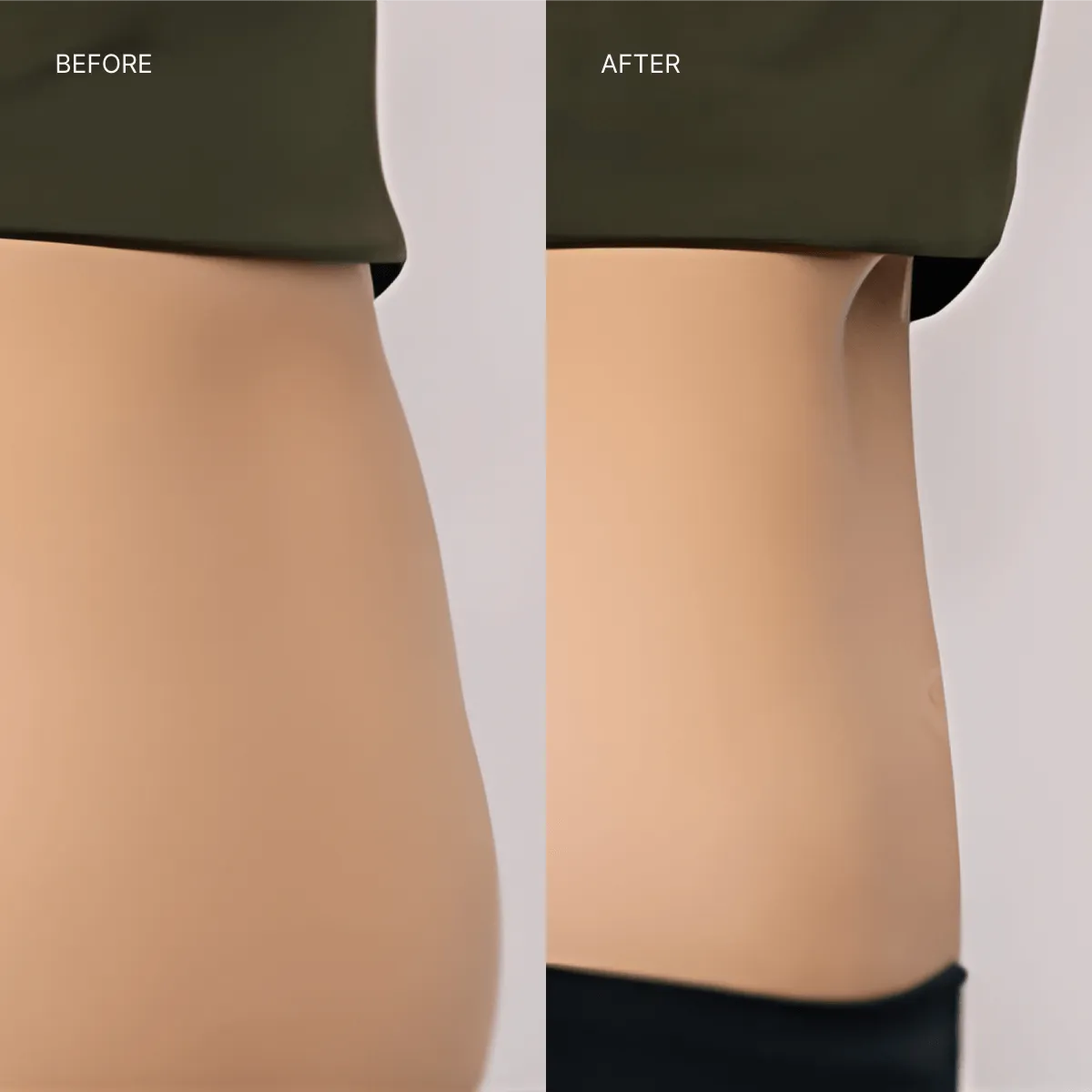 What Body Scuplting Can Help With