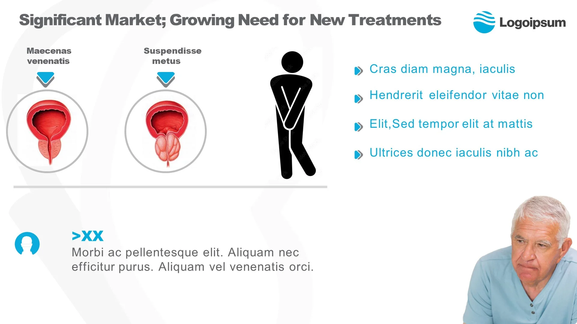 Clinical pathology slide comparing healthy vs. enlarged prostate using clear medical illustrations, optimized for a high-impact healthcare pitch deck