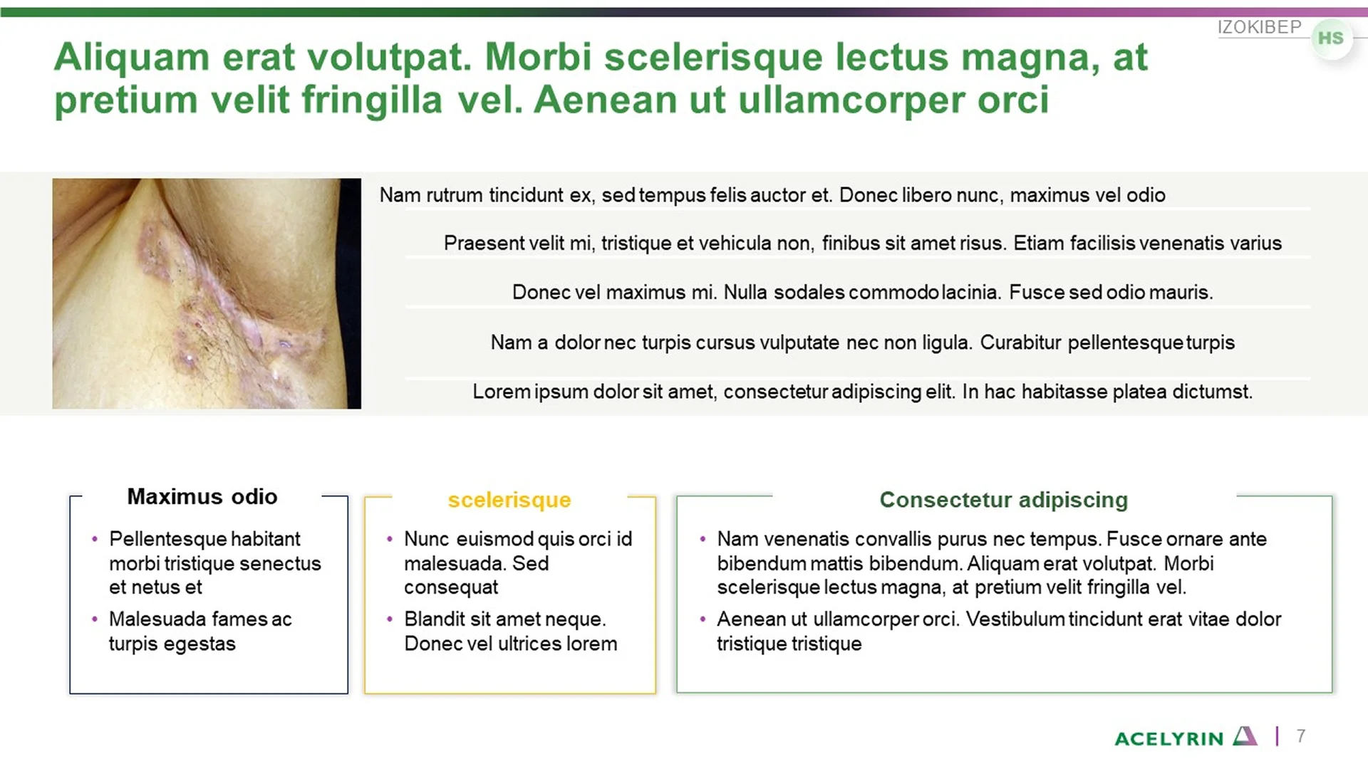 A pitch deck slide designed for clarity, featuring highlighted key points and concise text. This corporate overview deck example uses a clean structure to effectively communicate important information during presentations.