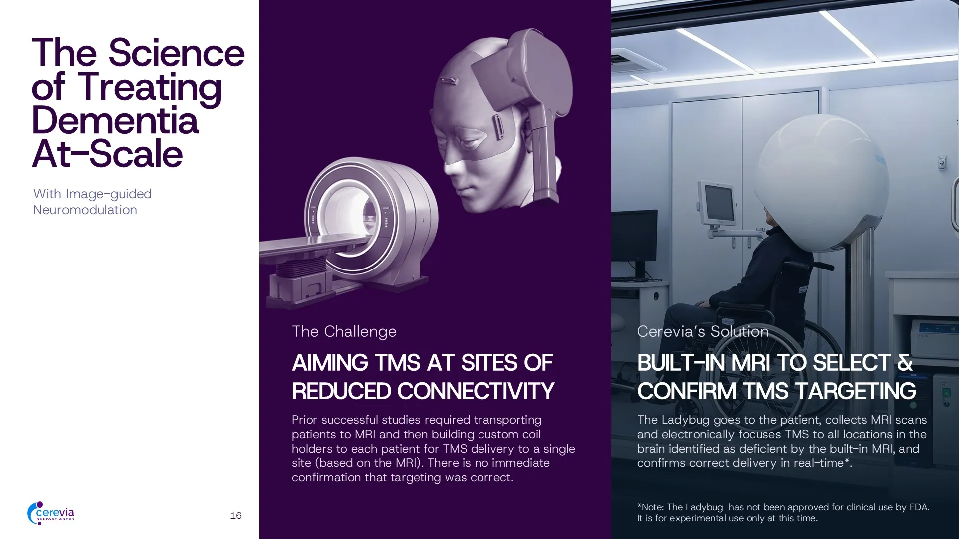 Final pipeline slide in a neuroscience Series A investor presentation, outlining a delivery-first CNS development pipeline across discovery, preclinical, and clinical stages