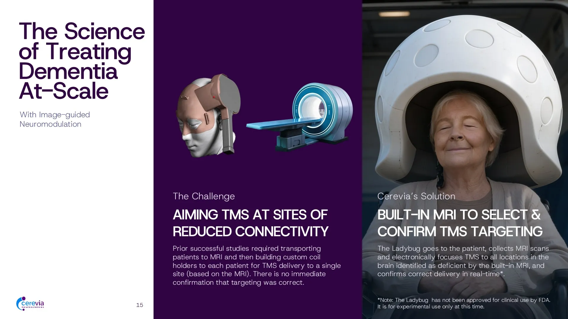 Final milestones slide from a healthcare pitch deck, showing clear 24–36 month validation points for blood–brain barrier transport and CNS platform expansion
