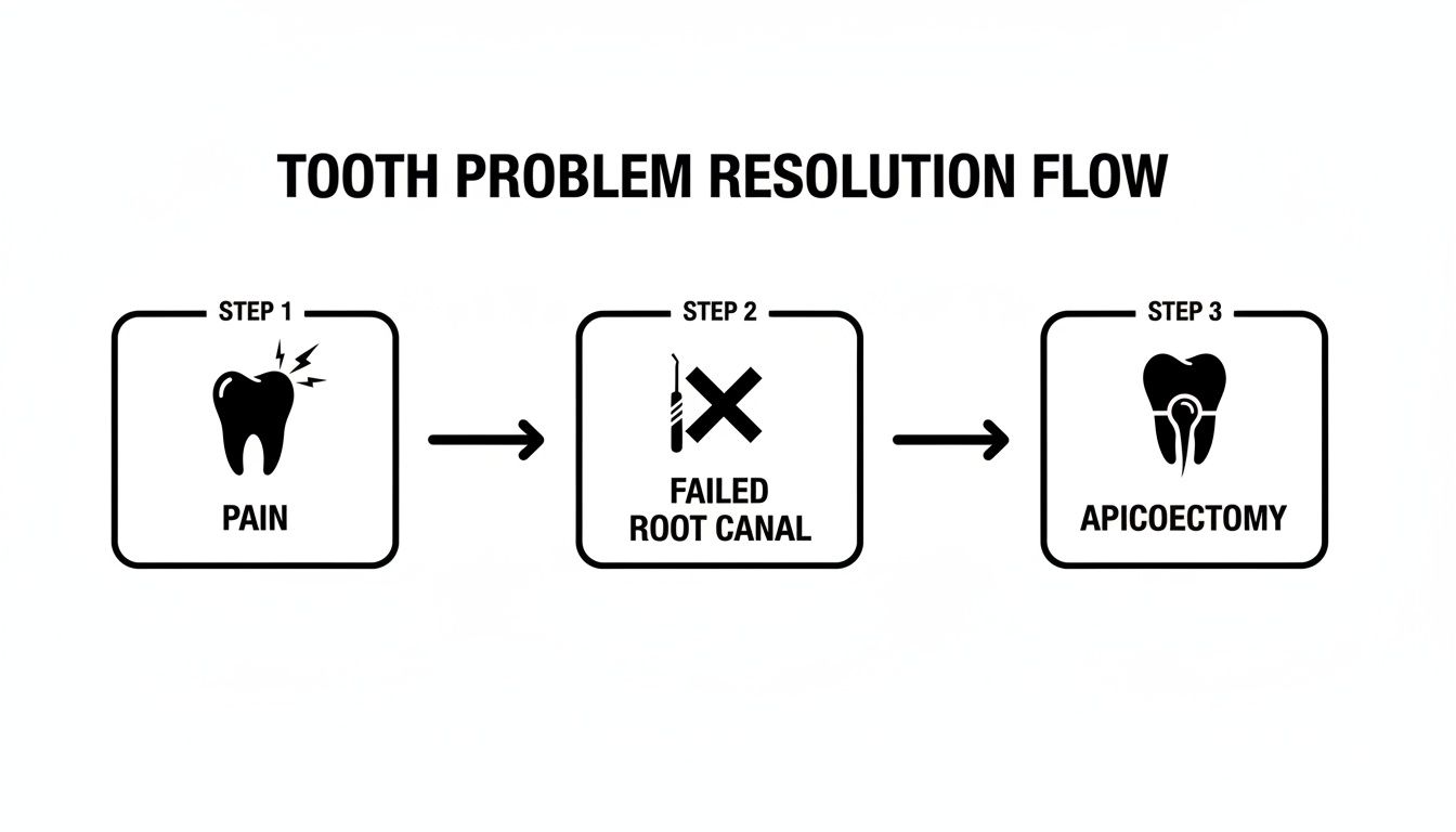 Flowchart illustrating tooth pain leading to failed root canal, then apicoectomy procedure.