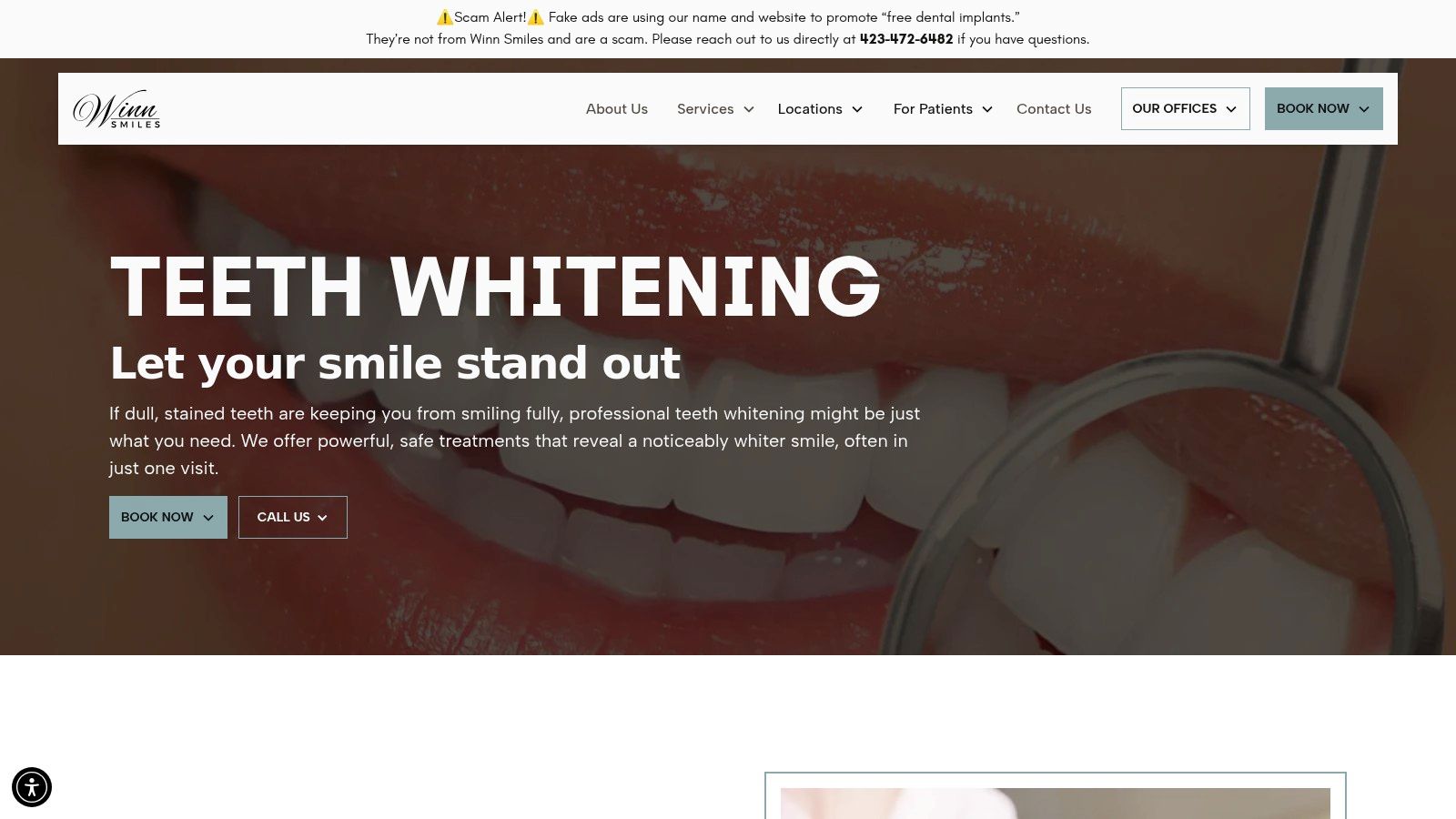 Professional Teeth Whitening in Cleveland & Chattanooga | Your Best Option at Winn Smiles