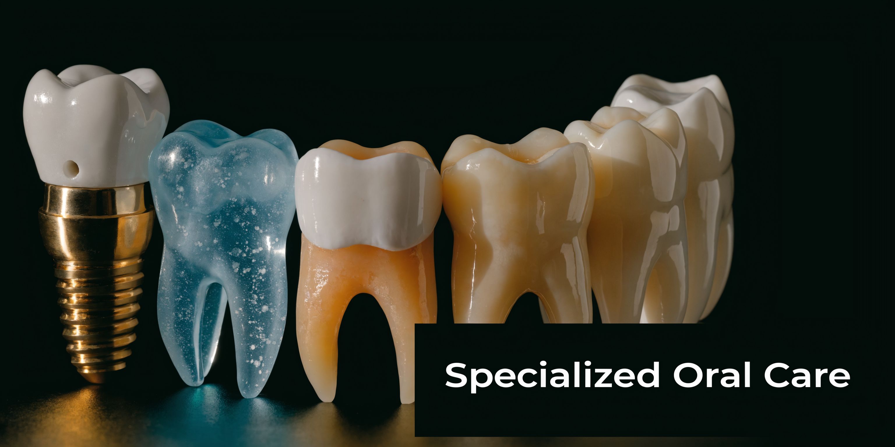 A row of various types of teeth models, including a metal dental implant, on a dark background.