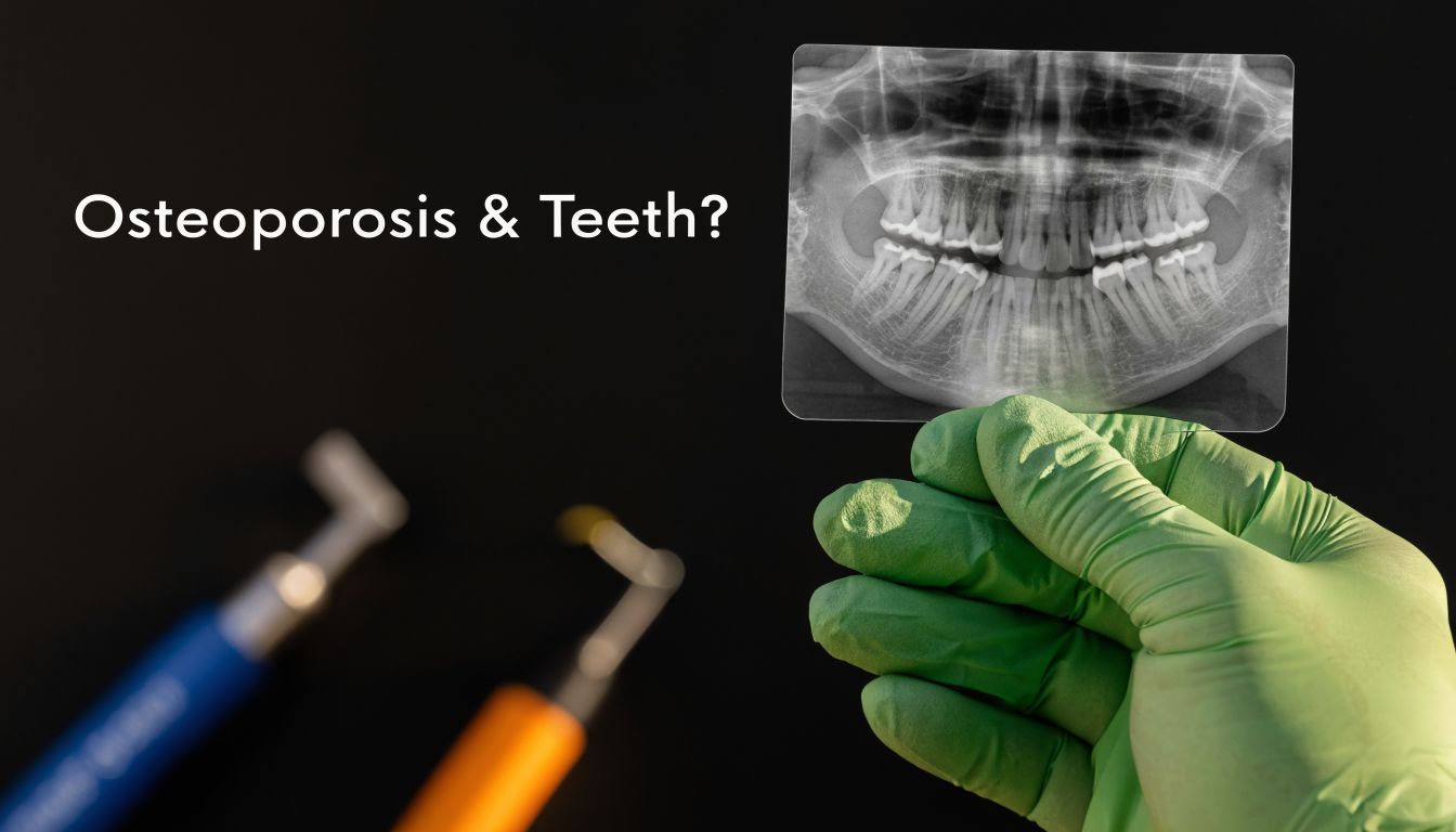Can Osteoporosis Affect Teeth?