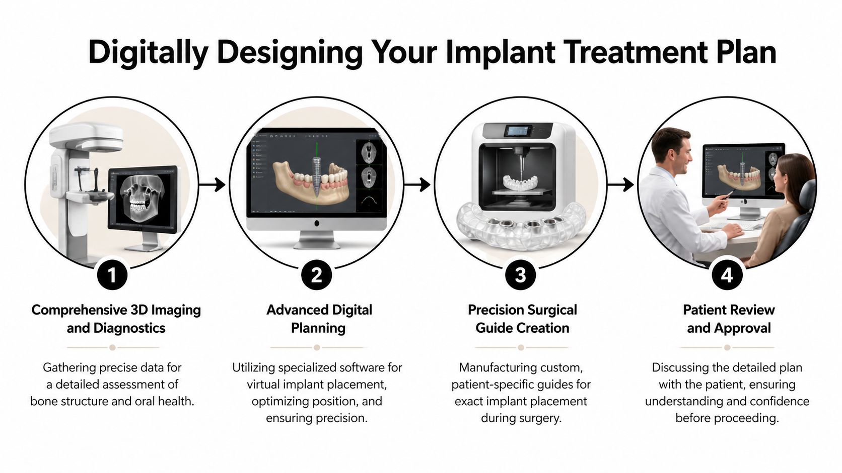 A four-step infographic illustrating the digital design process for patient-specific dental implant treatment plans.