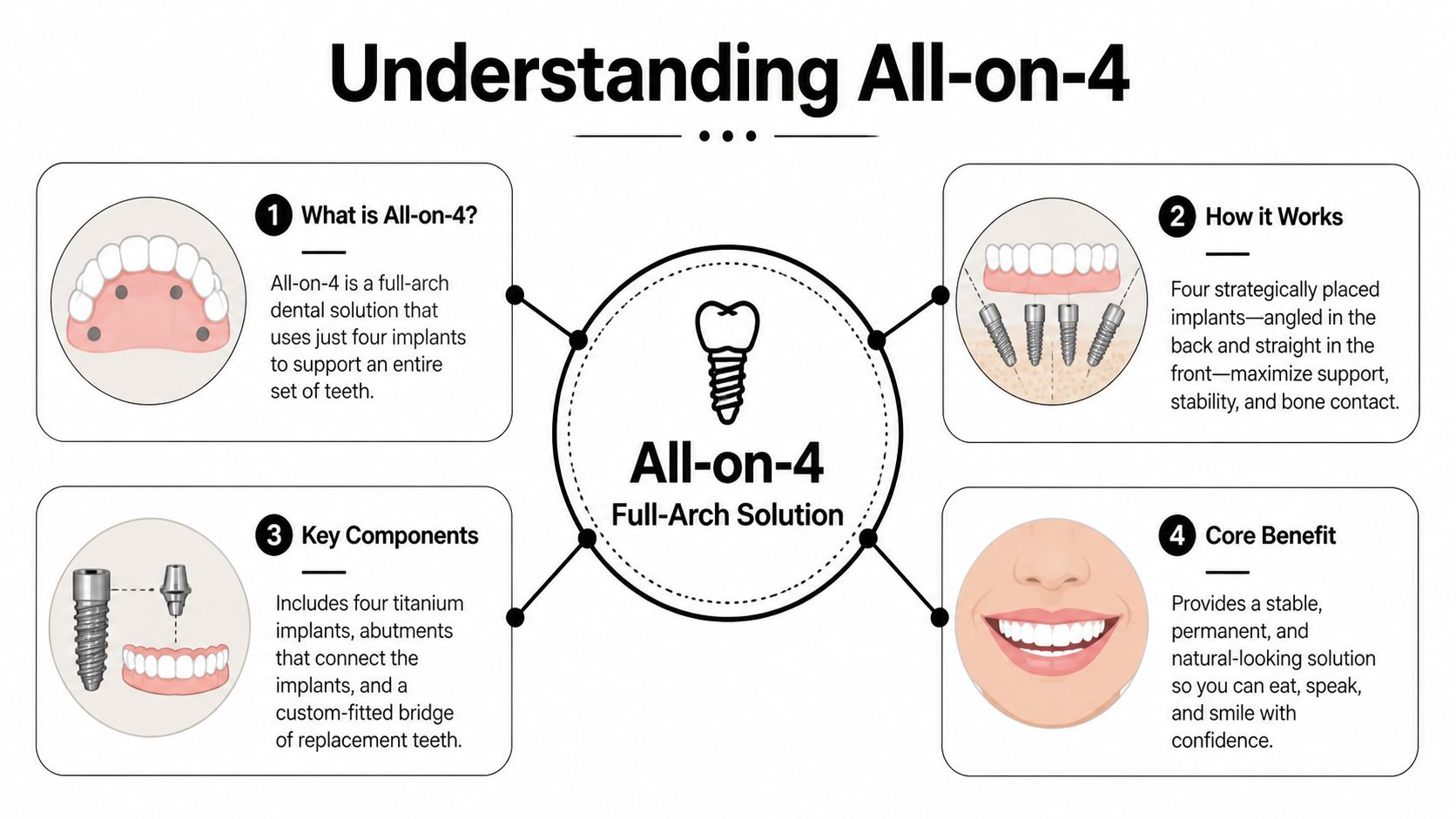 An infographic explaining the All-on-4 dental implant procedure, showing the components, benefits, and how it works.