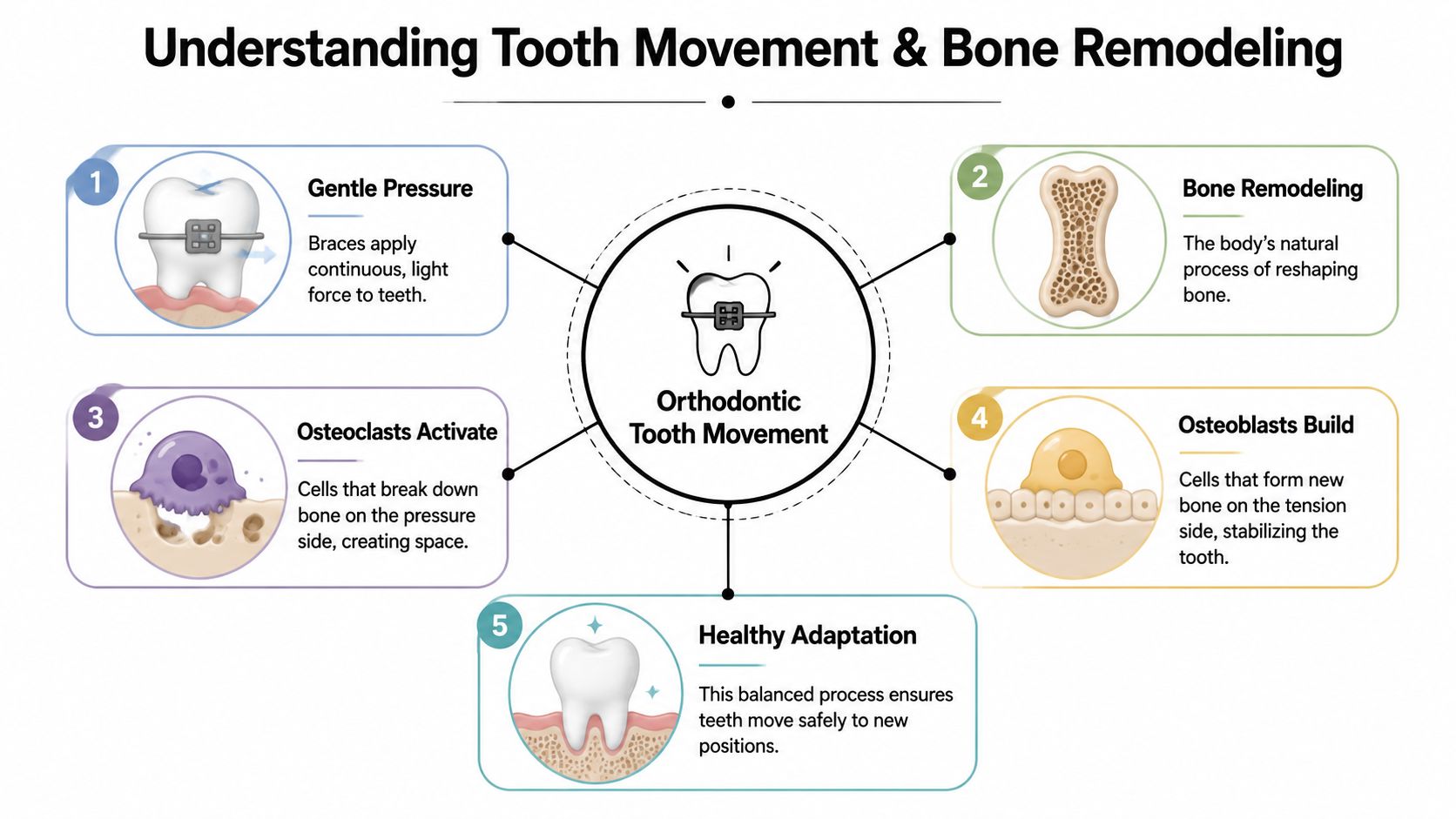 An infographic illustrating the biological process of orthodontic tooth movement and bone remodeling using braces.