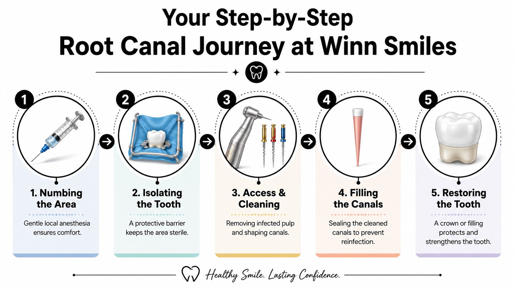 A five-step infographic illustrating the root canal procedure process from numbing to restoring the tooth at Winn Smiles.