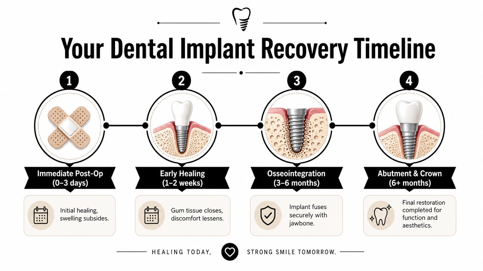 A four-stage infographic detailing the timeline for dental implant recovery from post-op to final restoration.