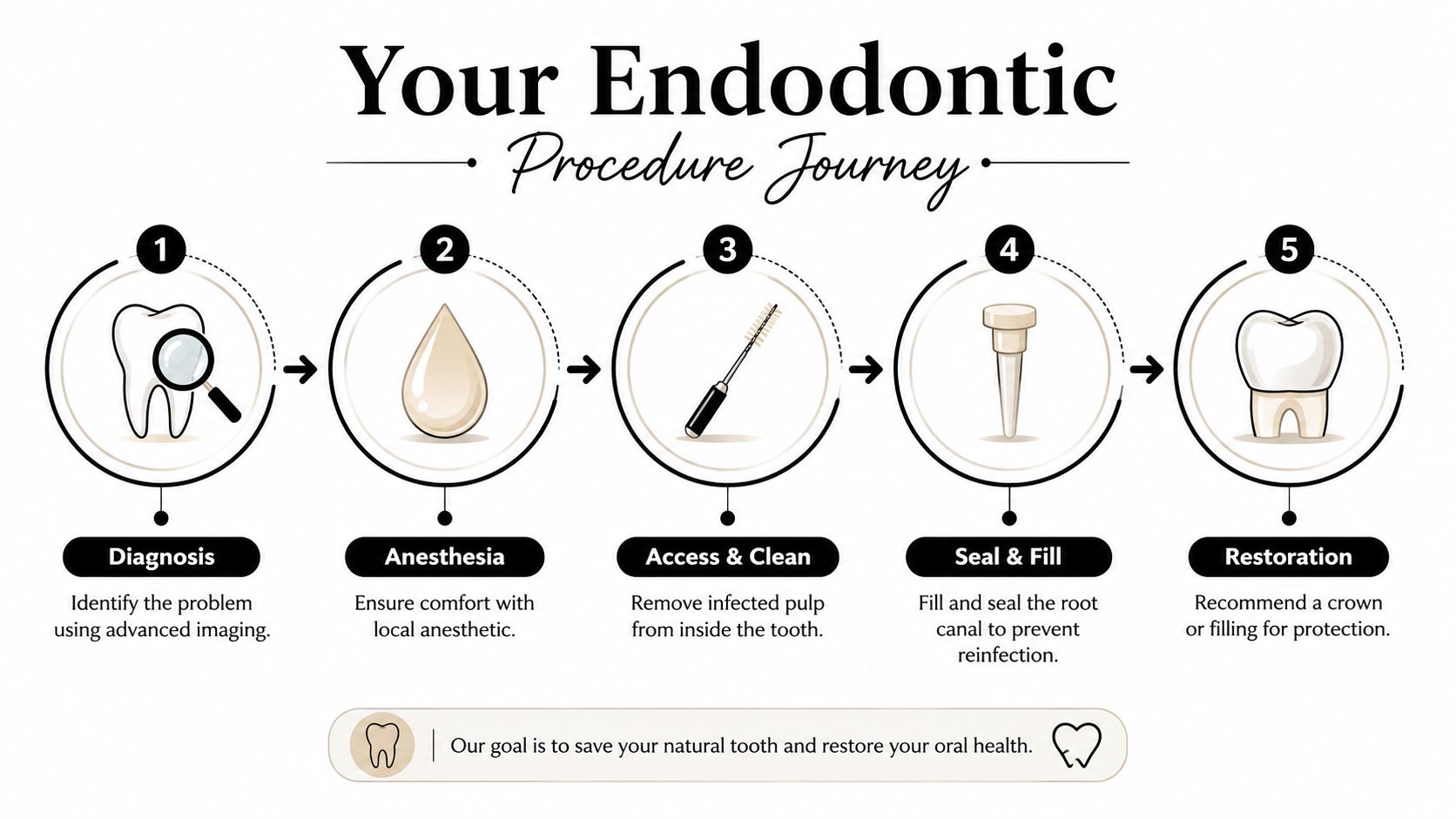 An infographic showing the five steps of an endodontic procedure journey for saving a natural tooth.