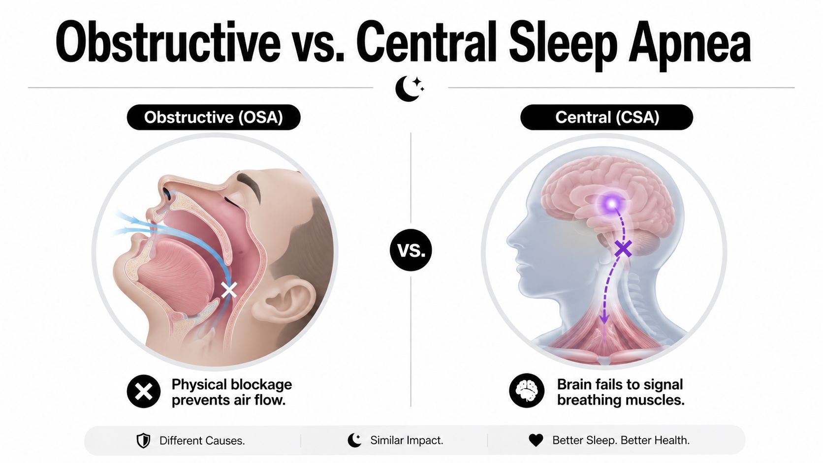 A diagram comparing Obstructive Sleep Apnea caused by physical airway blockage and Central Sleep Apnea caused by brain signals.
