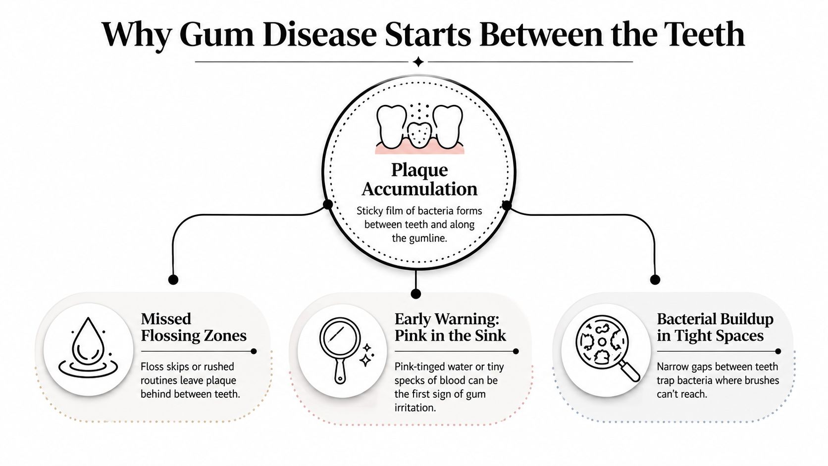 A diagram explaining why gum disease starts between teeth, featuring plaque accumulation, flossing, and early warnings.