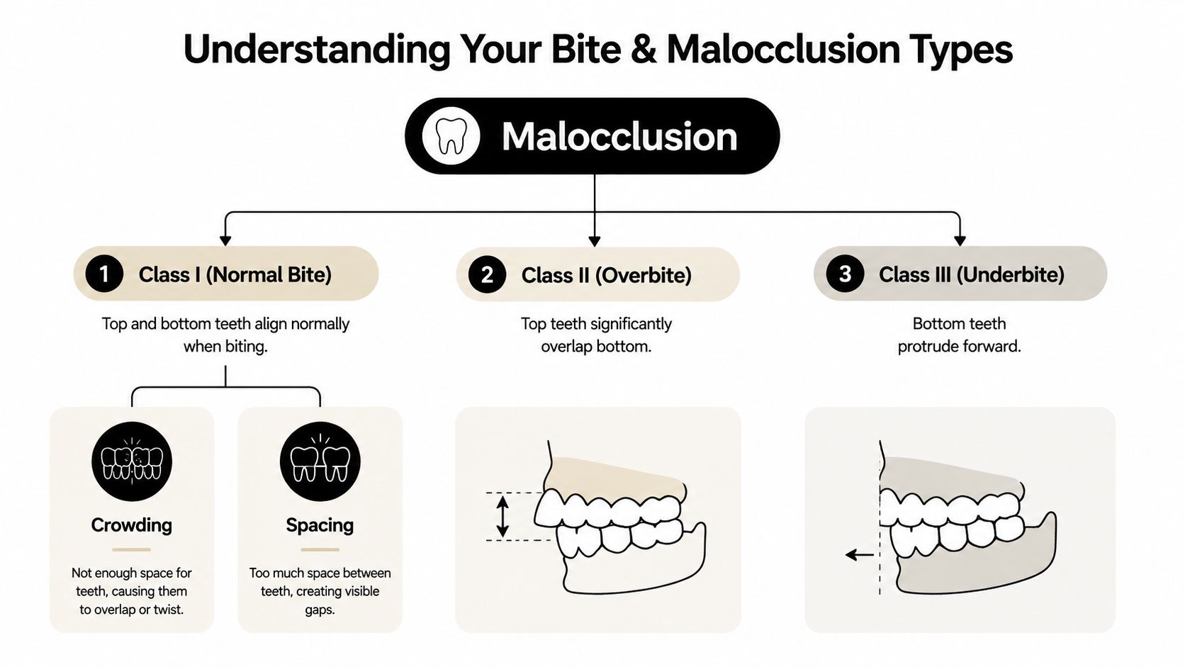 A dental infographic illustrating different types of malocclusion including Class I, Class II, and Class III bites.