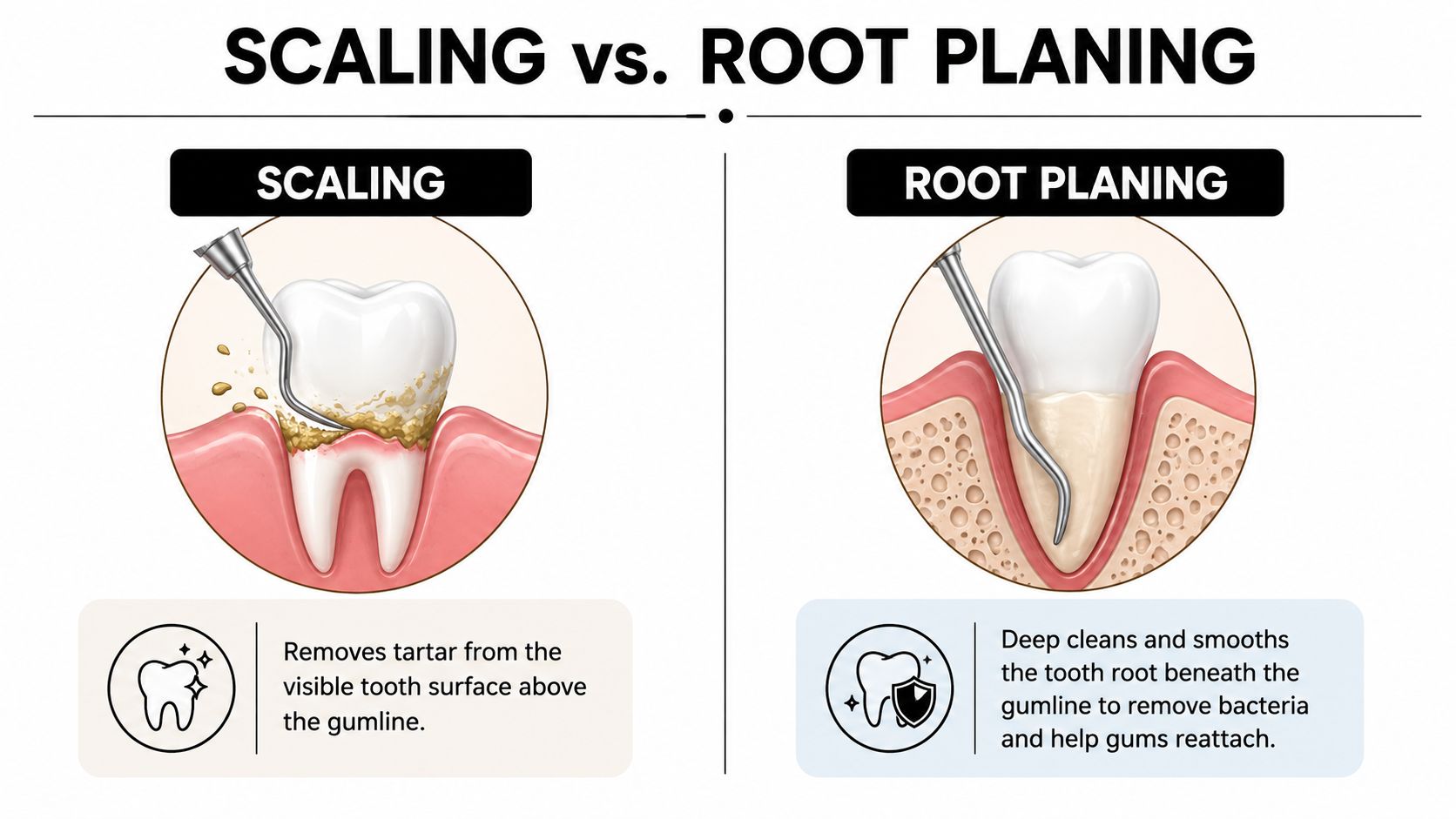 A diagram comparing dental scaling and root planing to show how they treat gum disease and plaque.