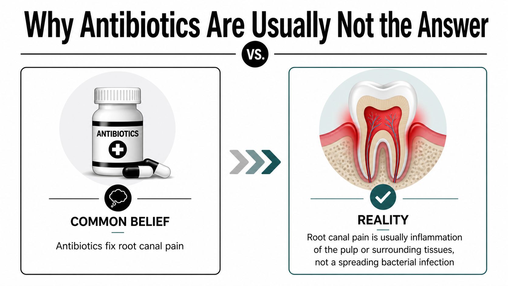 An infographic explaining that antibiotics do not fix root canal pain, as it is usually caused by inflammation.