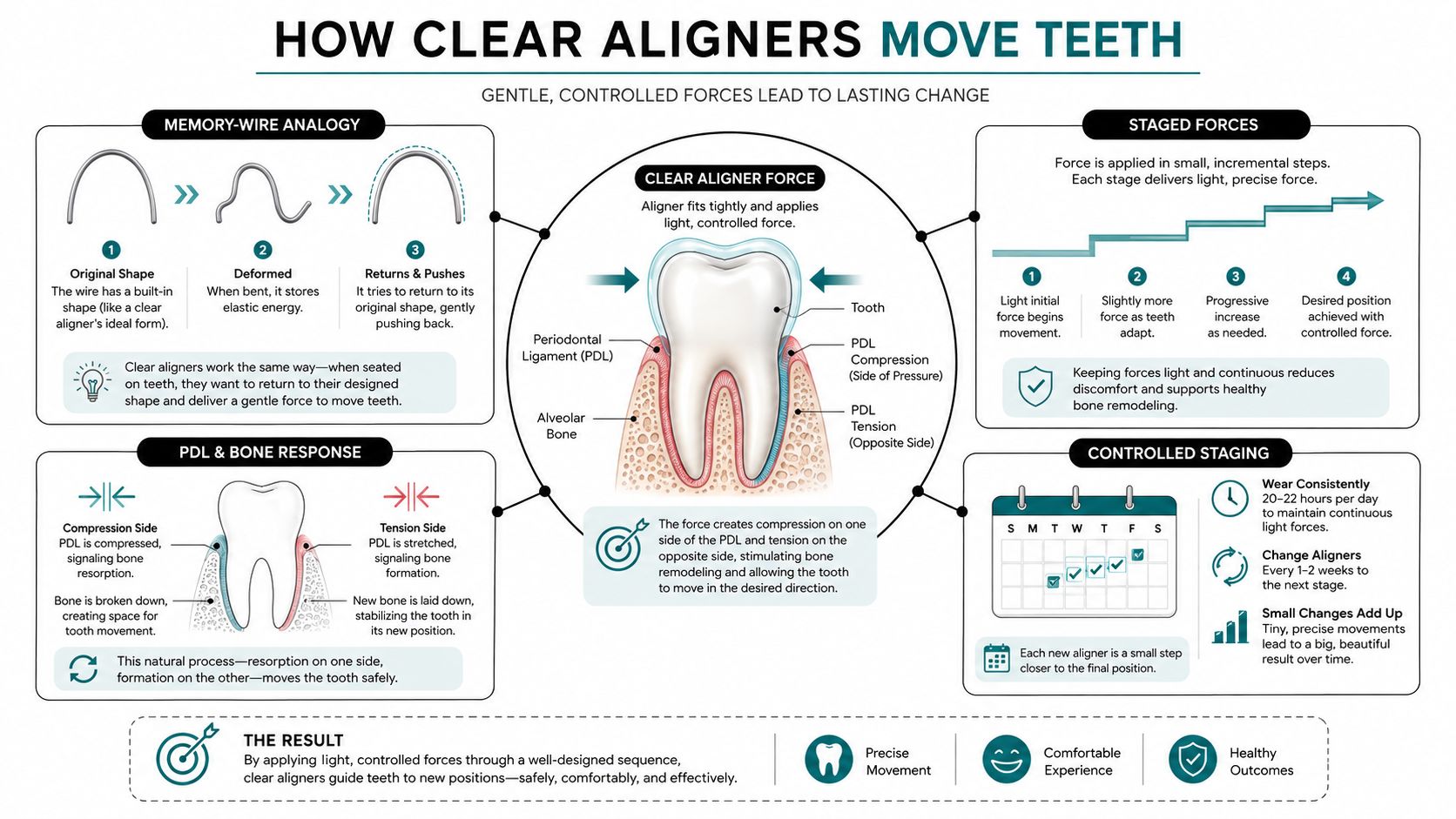 An infographic explaining the biomechanics and biological process of how clear aligners move teeth safely.