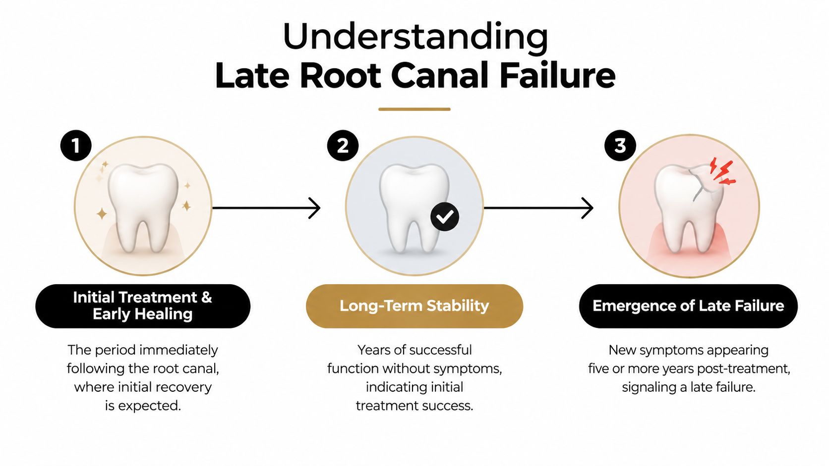 A diagram illustrating the three stages of late root canal failure over time.