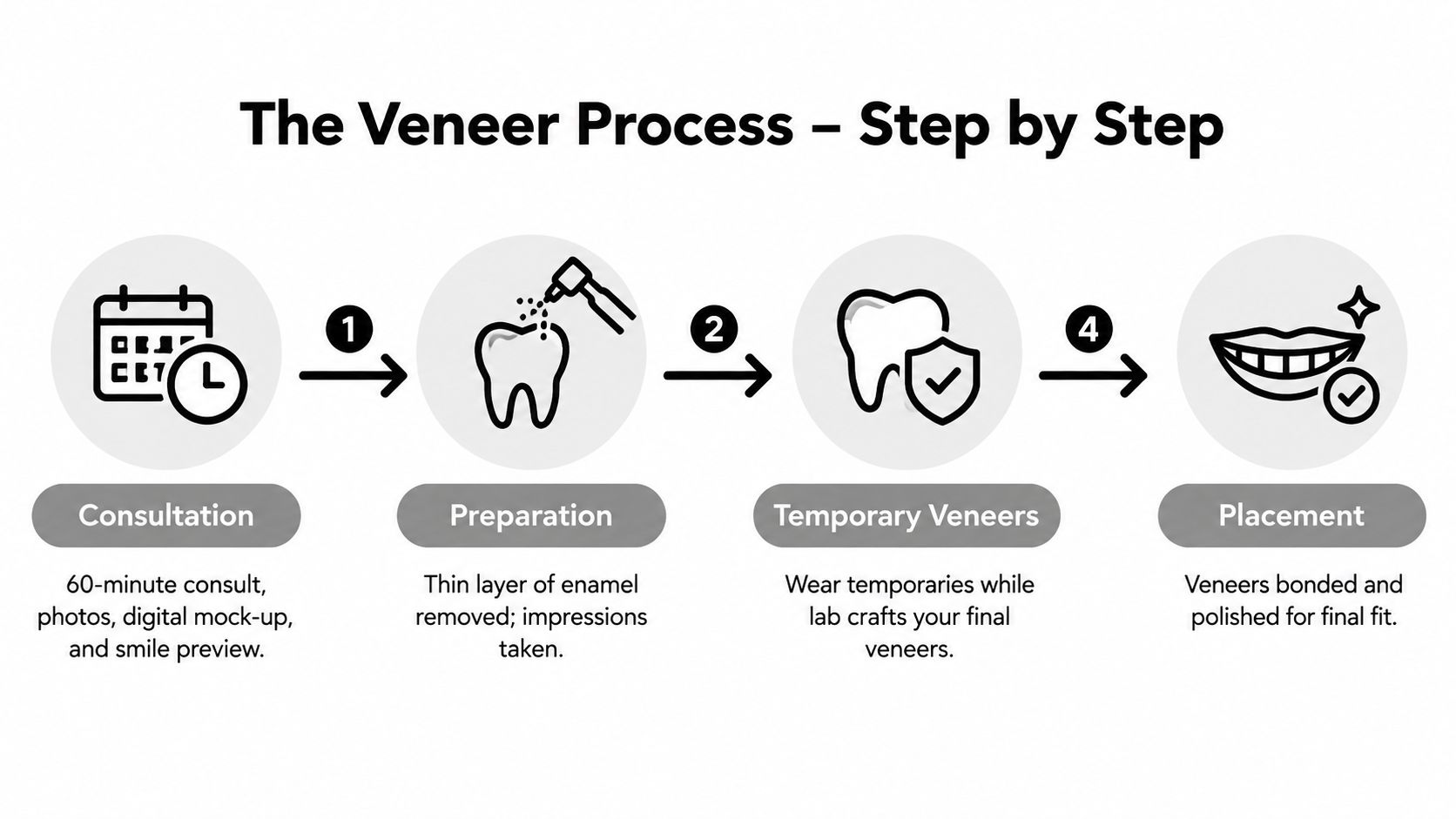 An infographic detailing the four-step dental veneer process from initial consultation to final placement.