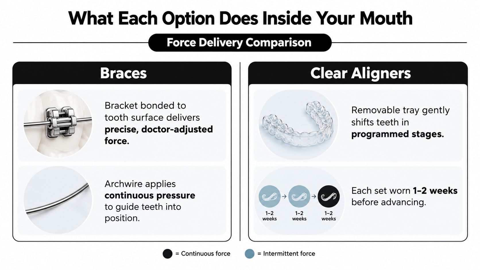 A comparison chart showing how braces and clear aligners apply force to teeth for orthodontic treatment.
