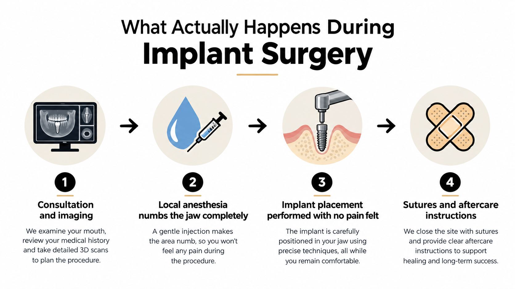 An infographic illustrating the four stages of a dental implant surgery procedure from consultation to aftercare.