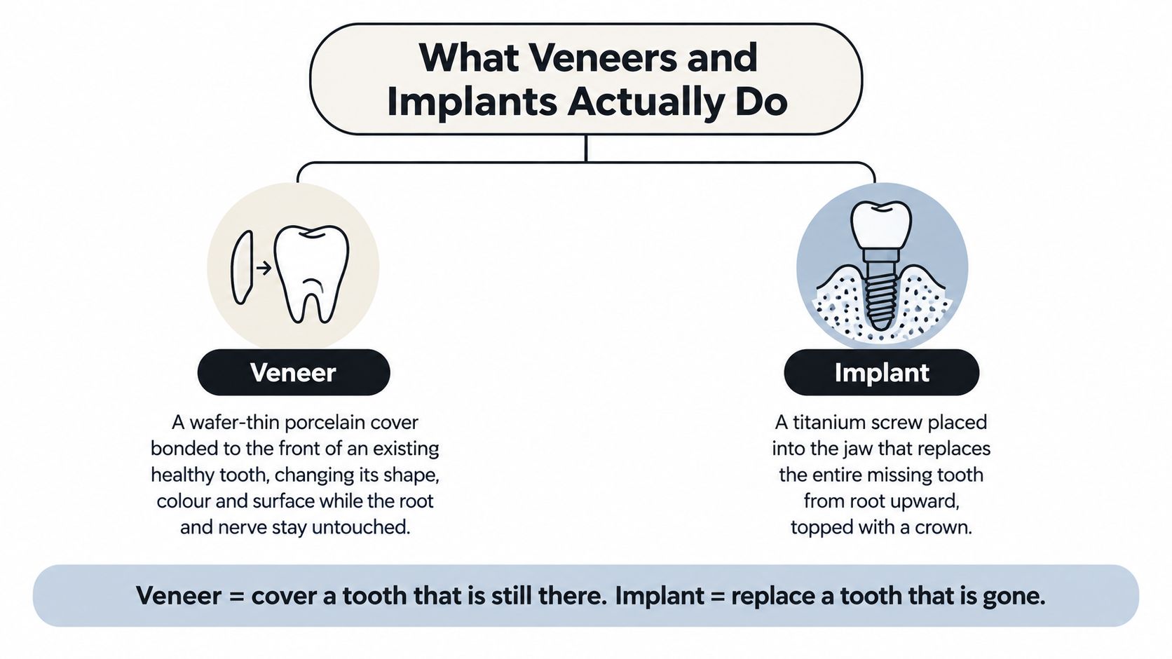 A diagram comparing dental veneers, which cover existing teeth, and dental implants, which replace missing teeth.