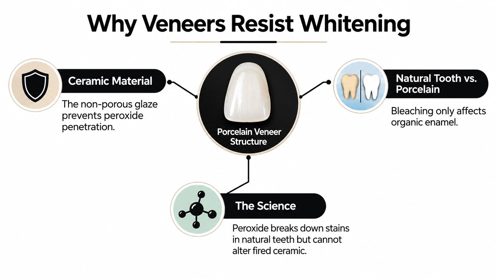 An infographic explaining why porcelain veneers do not respond to traditional tooth whitening treatments like bleaching agents.