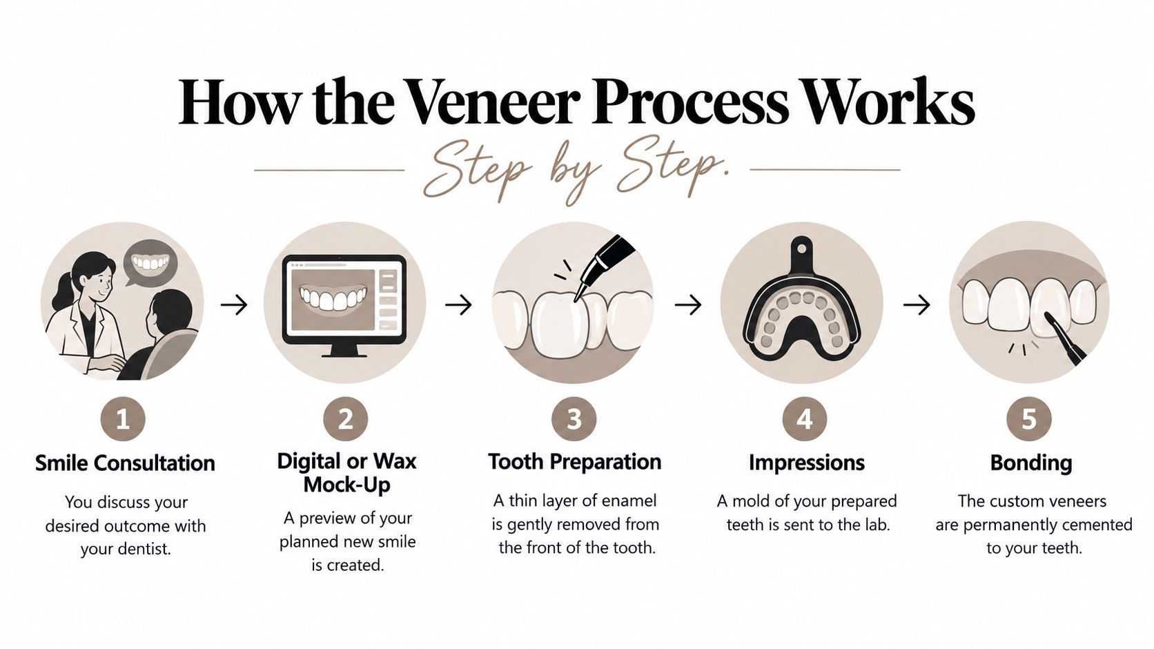 A step-by-step infographic showing the five stages of the dental veneer process from consultation to bonding.
