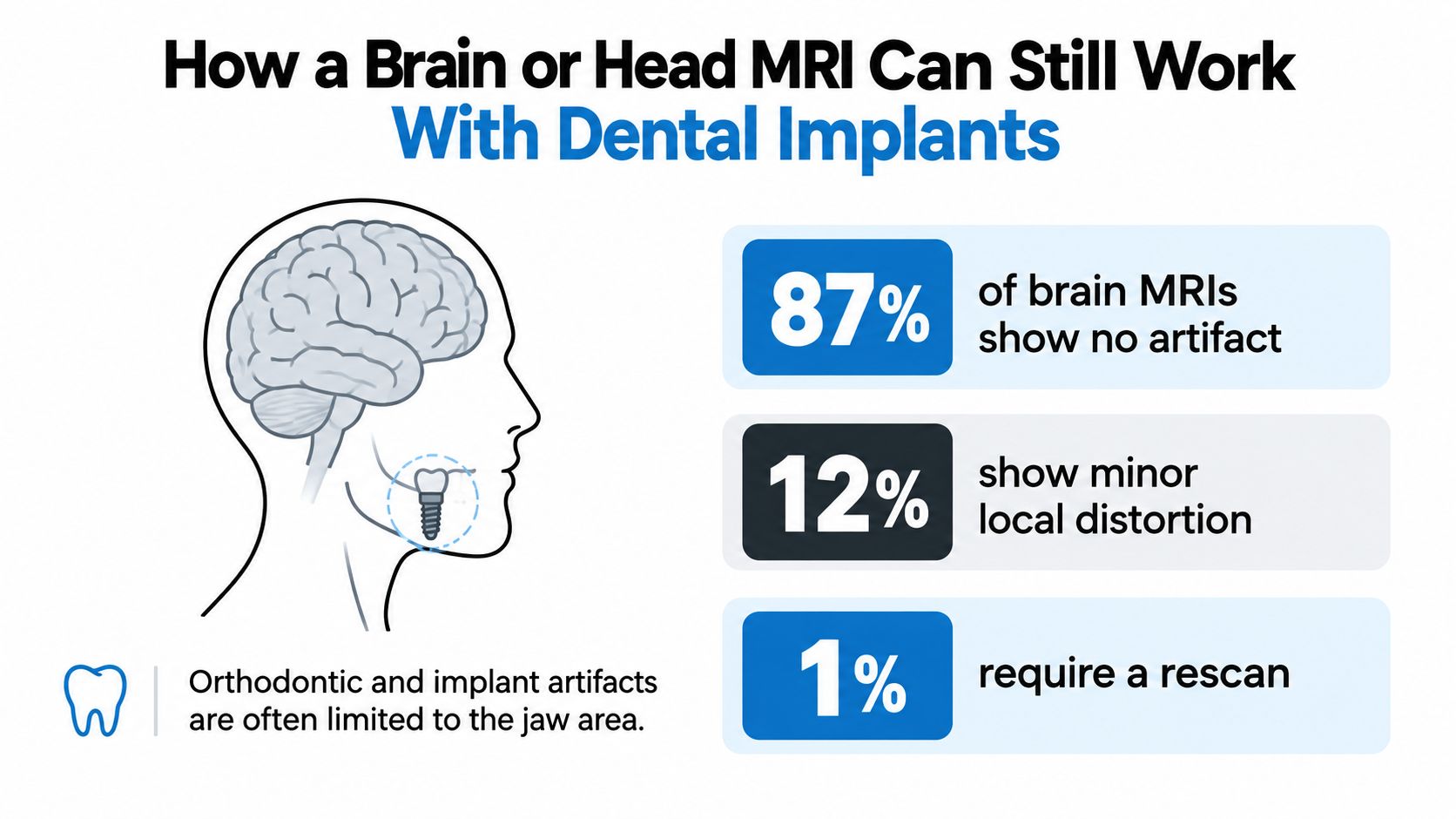An infographic illustrating that brain MRIs are typically safe and effective even with dental implants present.