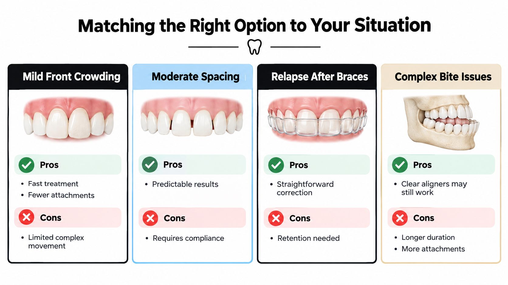 A chart comparing clear aligner treatment for mild crowding, moderate spacing, relapse, and complex bite issues.