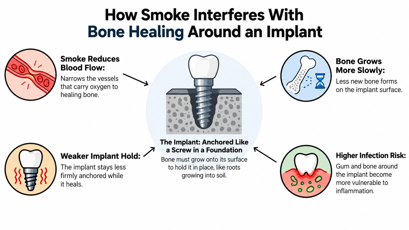 An infographic illustrating four main ways that cigarette smoking negatively impacts dental implant healing and bone osseointegration.