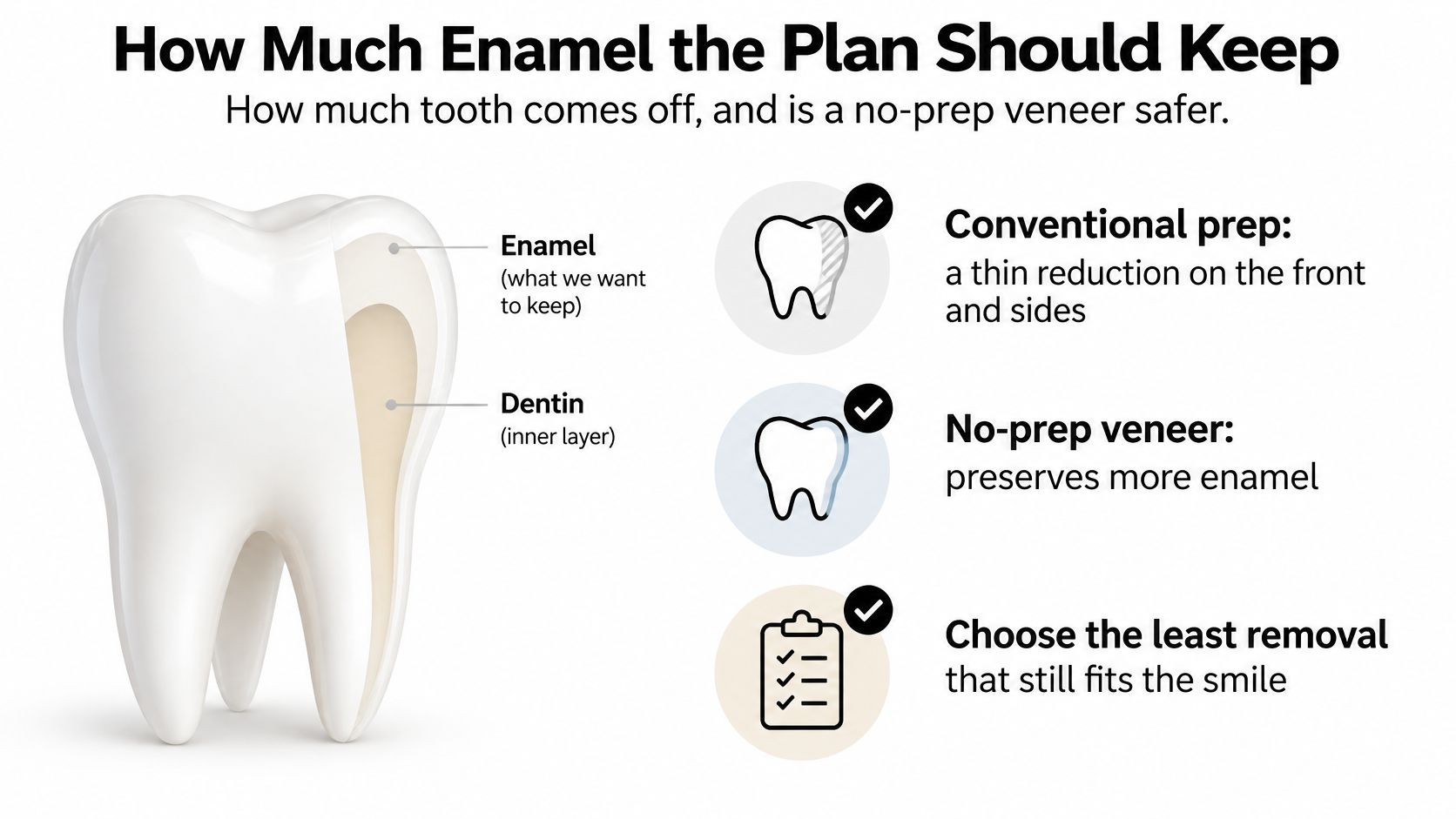 A dental diagram comparing conventional prep and no-prep veneer procedures, highlighting enamel preservation on a tooth.