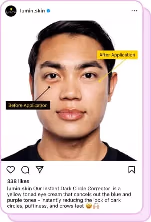 image showing before and after of lumin skin dark circle corrector