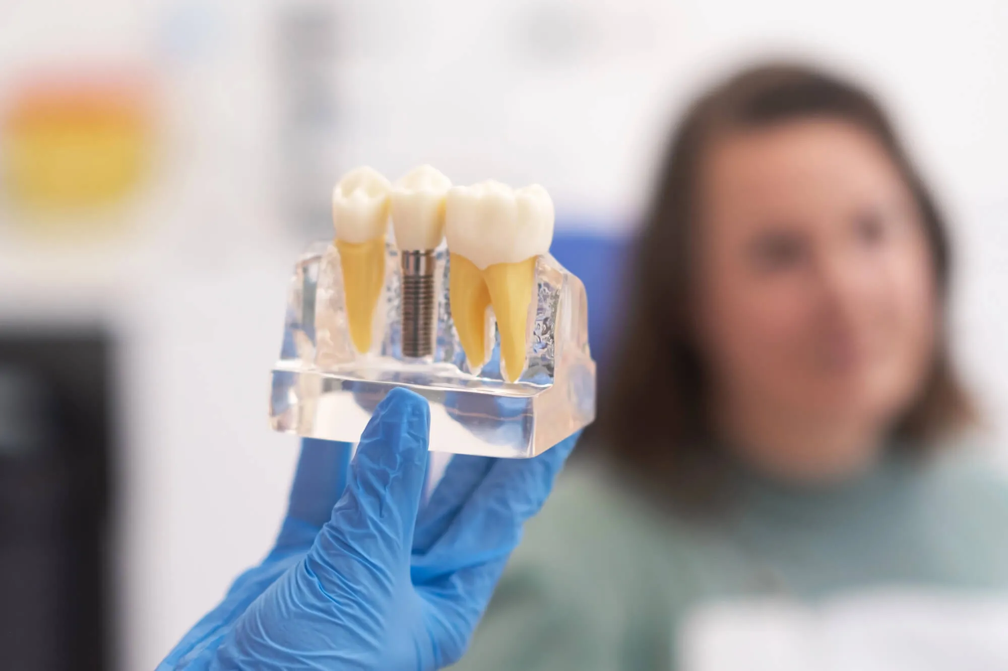 implant dentist birmingham al holding an implant model