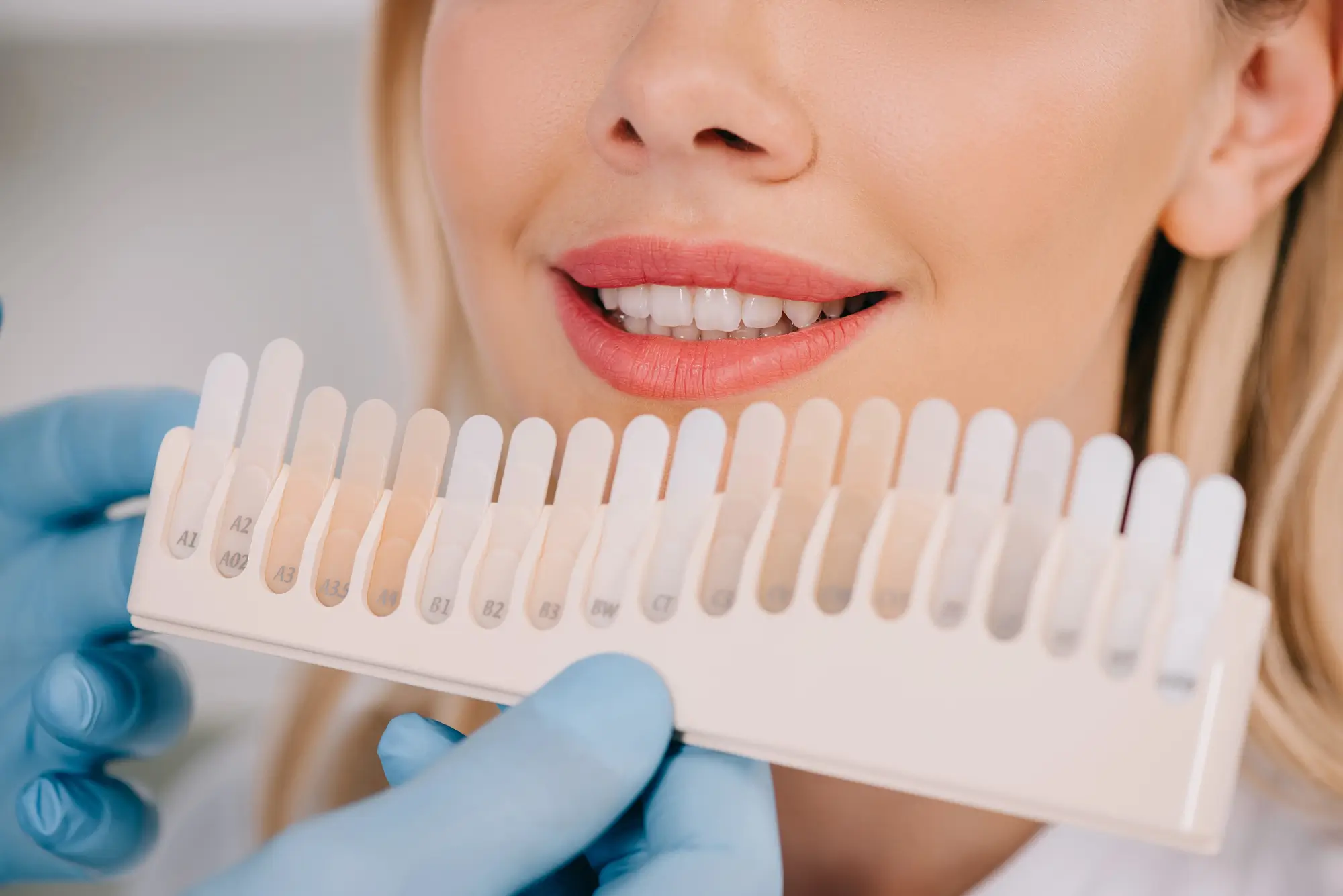 Teeth Shade Matching at Best Dentist in Trussville AL