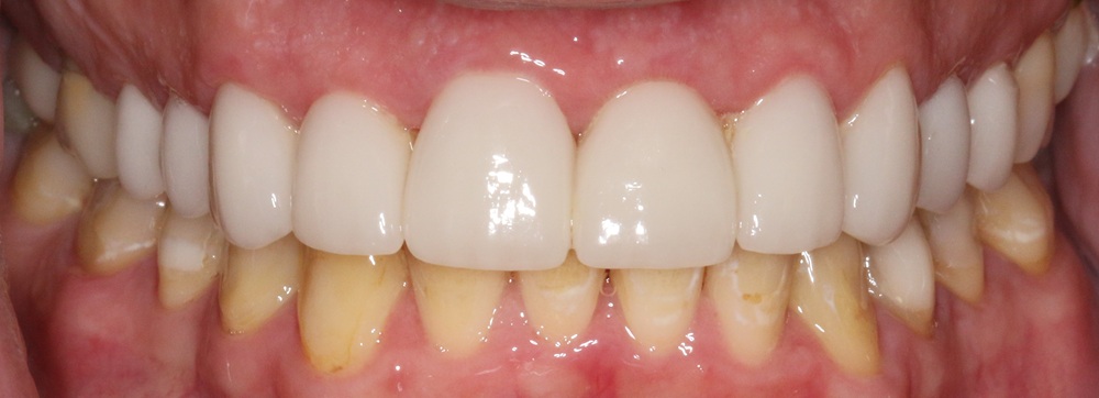 After Image