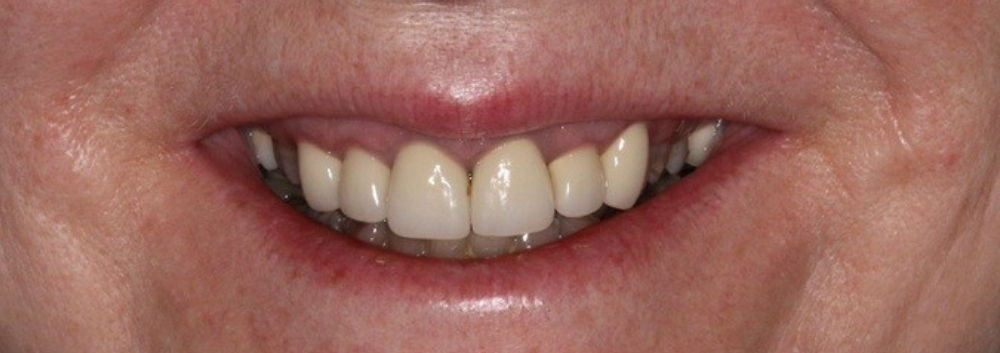Before Image