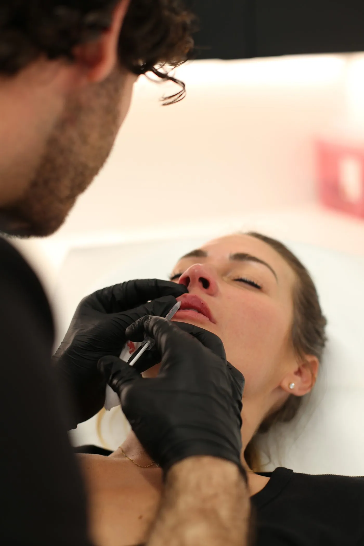 A patient receiving lip fillers in San Diego