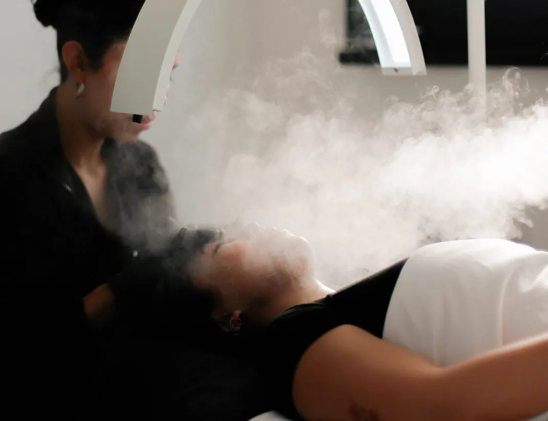 Acne treatment in San Diego
