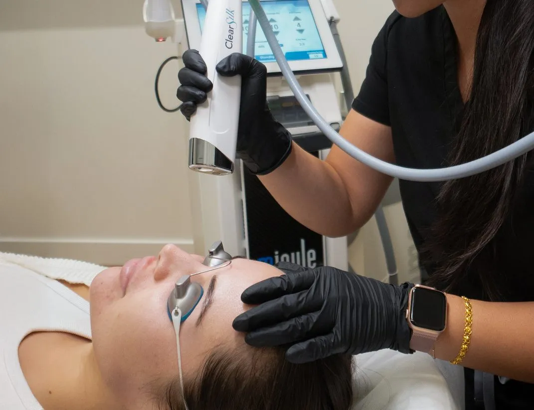 Clearsilk laser treatment for acne in San Diego