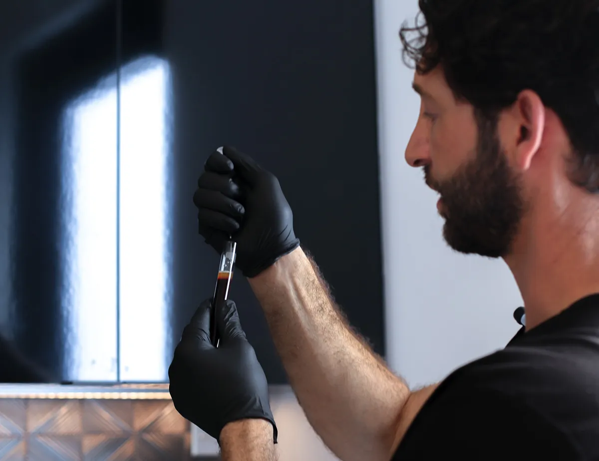 PRF (Platelet-Rich Fibrin) Hair Restoration