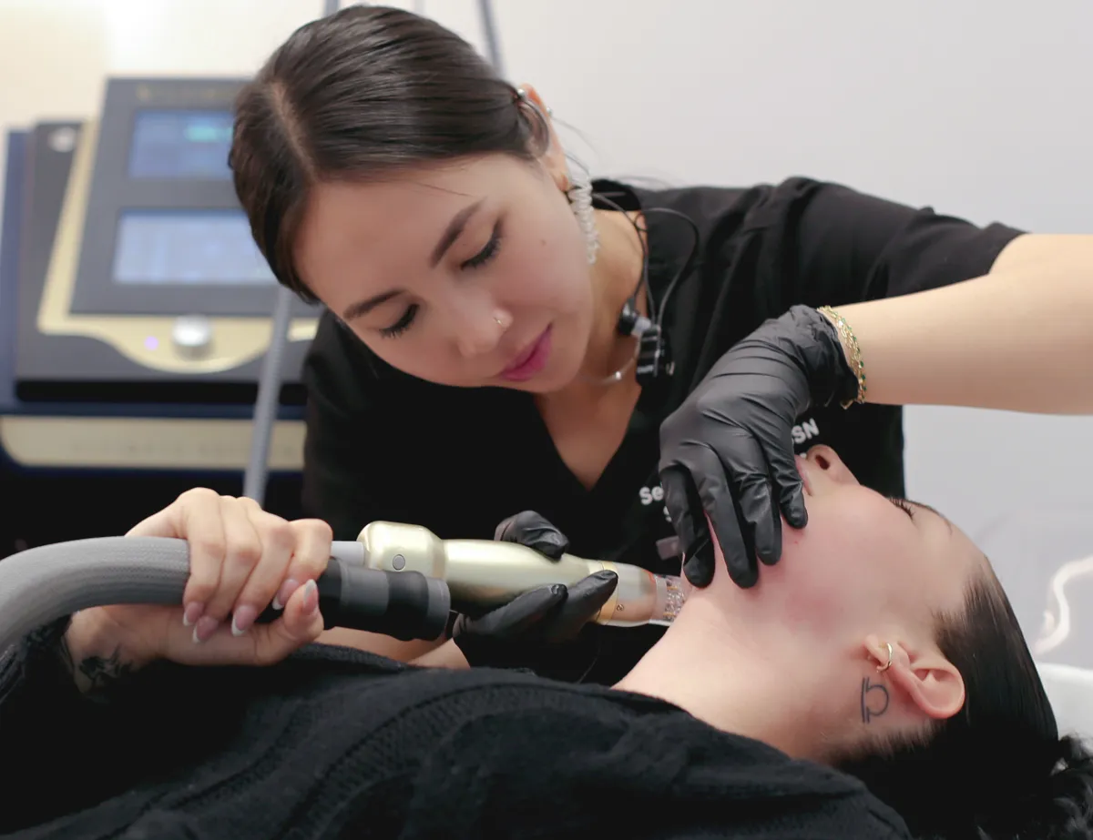 Medical practitioner treats patient with RF microneedling in San Diego