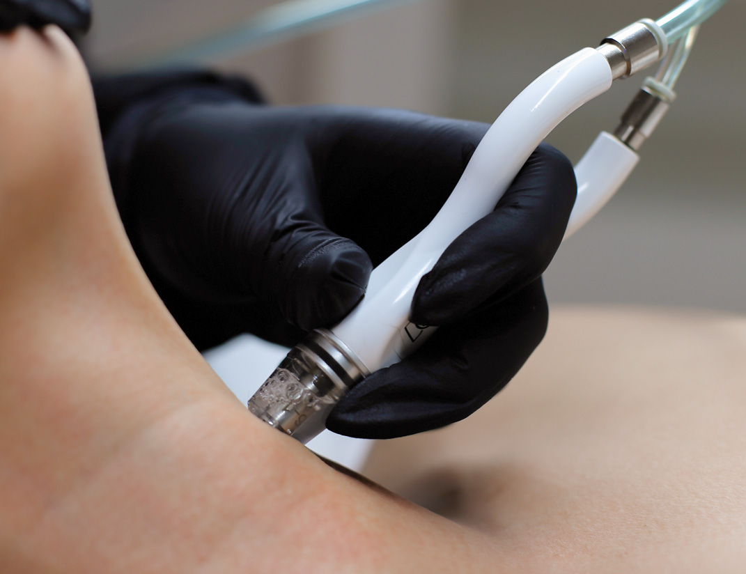 Woman receiving facial in San Diego