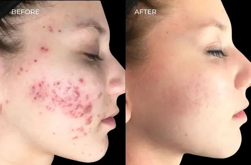 Skin Quality: Glass Skin + Pigmentation