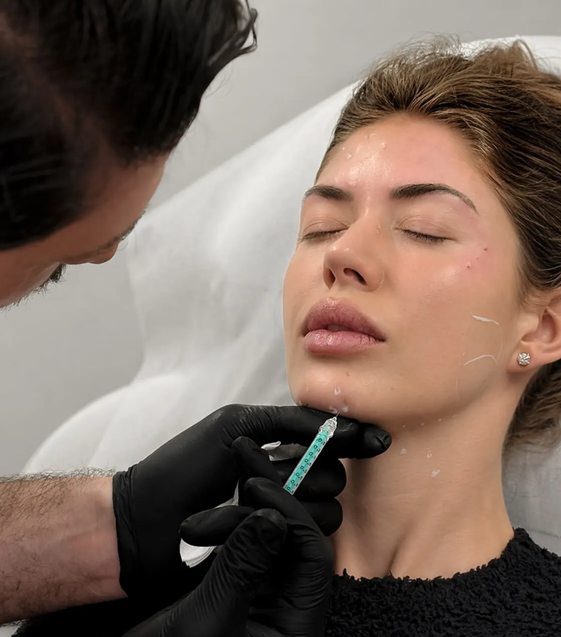 Masseter Botox treatment